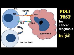 PDL1 TEST kyo karte hain || PDL1 BY VENTANA || PDL1 || IMMUNOTHERAPY TEST FOR CANCER DIAGNOSIS