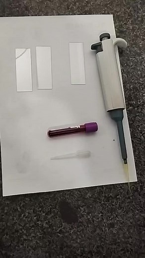 Guide to Preparing Peripheral Smear for Malarial Parasite Detection