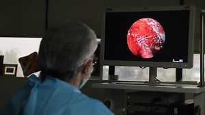 Flesh-eating 'black fungus' killing off patients who survived COVID-19