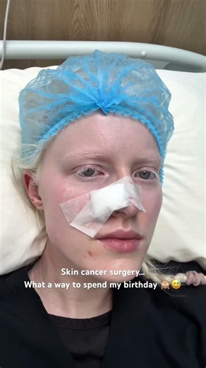 Skin cancer surgery #skincancer #cancersurgery #hospitalvlog #birthdayvlog #fairskin #ugcbeauty