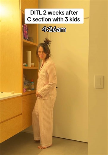 Postpartum Recovery: Navigating Swollen Neck Challenges