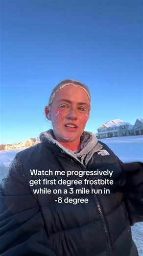 Avoiding Frostbite: A Runner's Cautionary Tale
