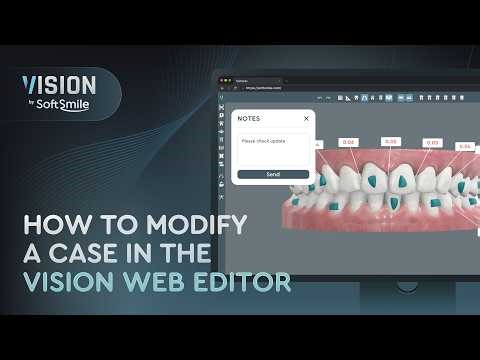 How to Modify a Case in the Vision Web Editor