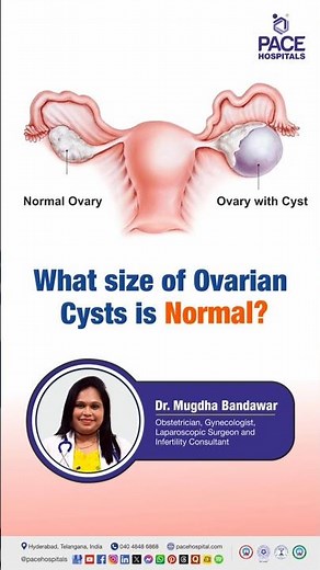 What size of Ovarian Cysts is Normal? | Typical Size Range for Ovarian Cysts #ovariancysts