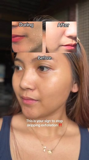 1.1K views · 52 reactions | Now see how important exfoliation is for our skin! ✨ With the help of #ExtraStrengthFilterFreeExfoliatingFacialSet, you can achieve clearer, smoother, and glass-like skin!  For just 300.00 SRP  Disclaimer: All rights to the rightful owner. No copyright infringement intended. #PerfectlyBrilliant ✨ #PerfectFormula離 #SHEDidIt | Perfect Formula Main | Facebook
