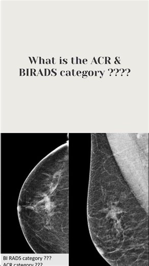 What is the ACR & BIRADS category ????