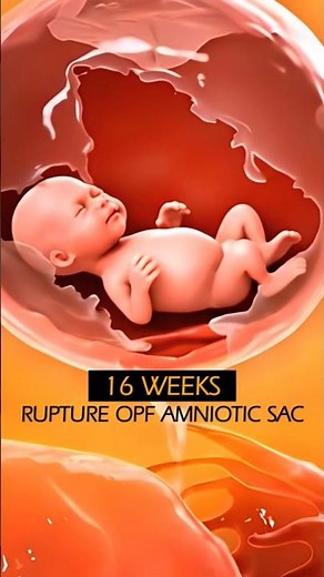 Ectopic Pregnancy in the Fallopian Tube ❤️ #baby #pregnancy #shorts