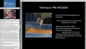 MIS TLIF: Technique and Short Stay Patient Pathway
