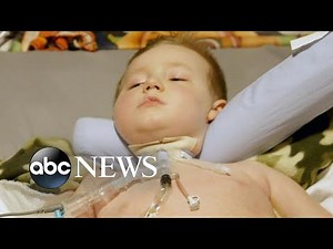 Children with AFM struggle to live with debilitating disease: Part 1 | Nightline