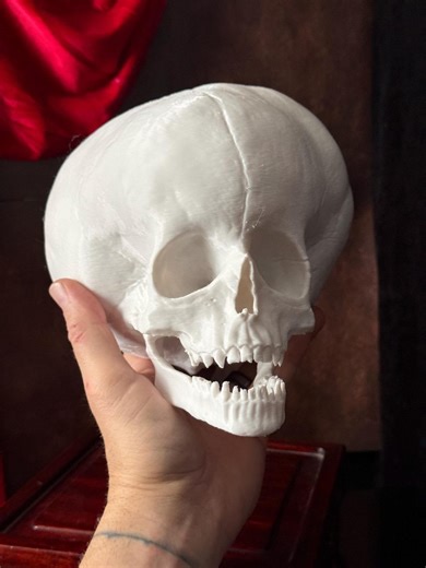 Hydrocephalus Skull Child Replica | Gothic Medical Oddity Display - Etsy