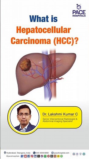 What is Hepatocellular Carcinoma (HCC)? | Basics of Liver Cancer #livercancer