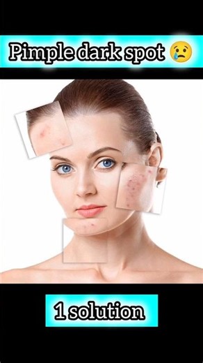 Aloe Vera Gelly: The Secret Weapon You Didn't Know You Needed #ytviral #ytshort