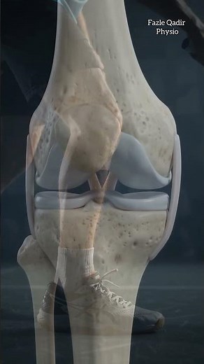 Meniscus Injury Explained 🦵 | Causes, Symptoms & Physiotherapy Treatment #physiotherapy