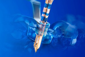 Cirurgia Guiada Arcsys - FGM Dental Group