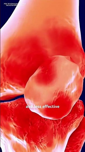 Visco Gel Injection For Treatment of Knee Osteoathritis (3D animation) #lowerextremity #extremities