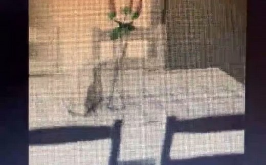 视雪综合征的一些症状模拟（2）visual snow syndrome