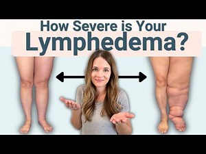 The Stages of Lymphedema - How Severe is Your Swelling?