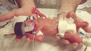 "I wanted this baby to live:" Born 1 lb 12 oz, miracle baby growing stronger at Children's Hospital