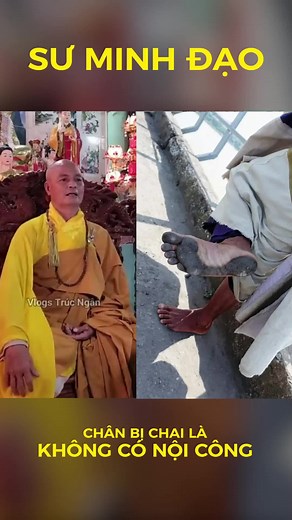 Giải thích lý do chân Thầy Minh Tuệ không chai