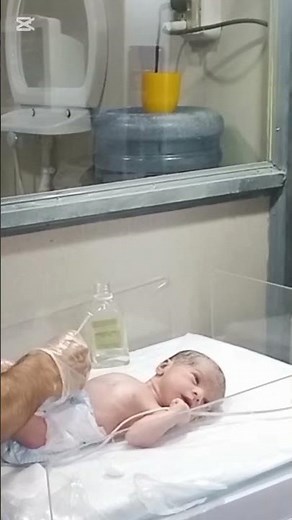 Vitamin K Injection for Newborn | IM Injection in Thigh | Neonatal Care