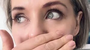 Hollyoaks' Steph Waring reveals bloody injury that's left a 'hole' in her lip