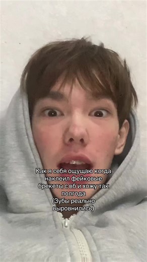 vslv (@vanyamrk4nm)’s video of False Teeth Dentures