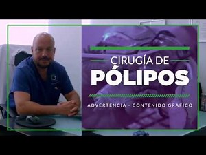 Polyps Surgery [Hysteroscopy]