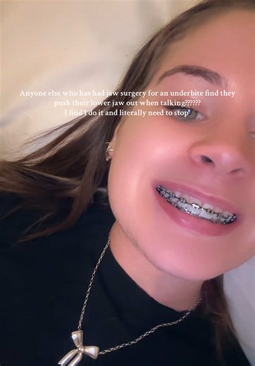 Understanding Jaw Surgery for Underbites