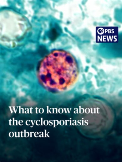 A cyclosporiasis outbreak has now affected more than 1,700 people and counting. More than two dozen states are investigating cases of the foodborne parasitic infection. While it’s not fatal, symptoms can include “frequent and sometimes explosive bowel movements,” according to the Centers for Disease Control and Prevention. The source of the outbreak is unknown; the cyclospora cayetanensis parasite can be hard to track as it can’t be reproduced in a lab and it is not always detected through food