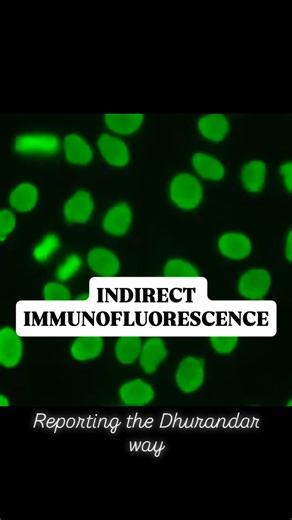 Praveen Kr on Instagram: "Decoding ANA Patterns: A Visual Guide Understanding Antinuclear Antibody (ANA) patterns is like reading a roadmap for autoimmune diagnostics. Each pattern seen under Indirect Immunofluorescence (IIF) points toward a specific set of autoantibodies and clinical conditions. 💡 The Patterns & Their Significance: • Homogeneous: The entire nucleus is evenly stained. This is often associated with Systemic Lupus Erythematosus (SLE) and drug-induced lupus. • Speckled: Characteri