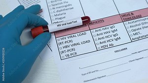HIV viral load, doctor checking name in lab blank, showing blood sample in tube