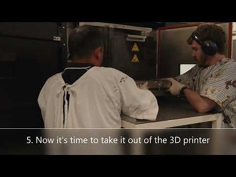 Korthotics - The Process of 3D Printed Orthoses