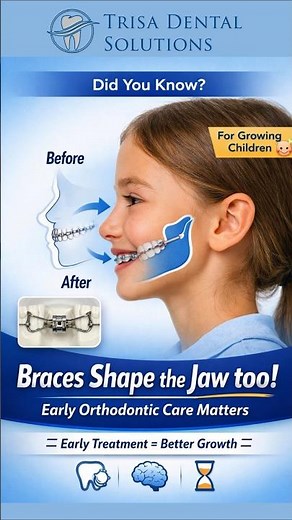 Braces Don’t Just Move Teeth — They Shape Your Child’s Jaw | Early Orthodontic Care