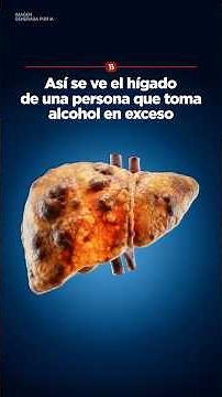This is what the liver of a person who drinks alcohol excessively looks like.
