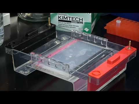 Electroforesis en gel de agarosa