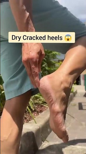 🔥 How To Get Soft, Bright & Clean Feet at Home 👣✨ | Easy DIY Foot Care Routine