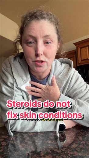 Please, if you take anything away from my videos, let it be not to use steroids to treat skin conditions. Eczema is not a problem of your skin. It is a problem internally that needs to be fixed. Steroids are literally a Band-Aid and we all know that Band-Aids fall off. Steroids are not the answer for skin problems! ##tsw##topicalsteroidwithdrawal##nmt##eczema##rlt