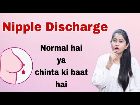Female Breast se Discharge hona wo bhi bina Pregnancy ke #bebold | Tanushi and family