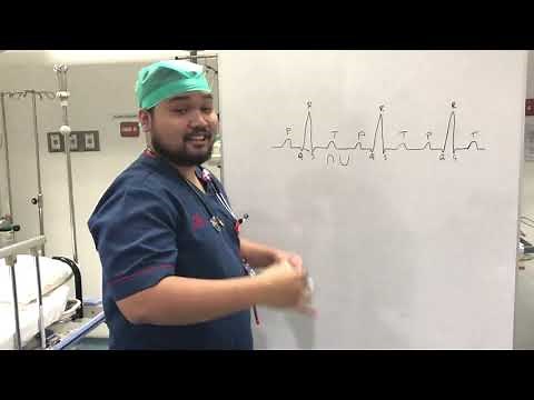 CARA CEPAT DAN GAMPANG INTERPRETASI EKG (PART 1)
