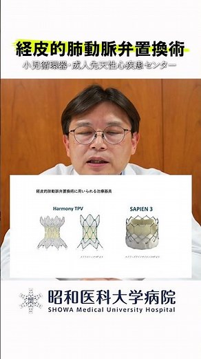 【経皮的肺動脈弁置換術】具体的な治療法は？ #昭和医科大学病院 #子供の心臓病 #小児循環器 #小児心臓 #先天性心疾患 #妊娠 #出産 #経皮的肺動脈弁置換術