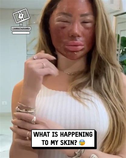 My skin is swelling up... 😶‍🌫️🫧 #skincare #beauty | UNILAD