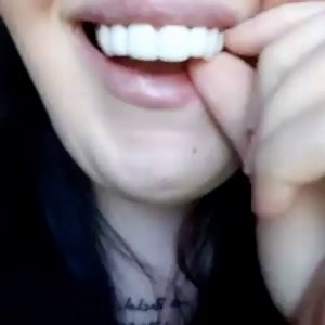 Emotional issues of embarrassing teeth 😱😩😱😄 Many issues can arise from something as serious as tooth loss or staining: depression, poor self-esteem, and speech problems. These problems can lead to a person isolating themselves and being unwilling to socialize. When teeth staining or tooth loss is quite apparent (perhaps a front tooth is missing) the depression and social anxiety can increase. Individuals feel self-conscious and less attractive. They are often unwilling to talk and smile as t