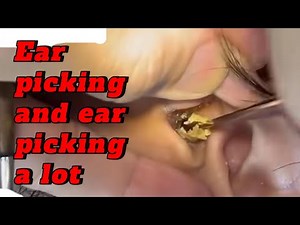 Ear picking and ear picking a lot