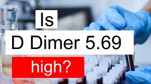 Treatment and symptoms of D Dimer 5.69 ug/mL | Diet for high D Dimer level 5.69 ug/mL