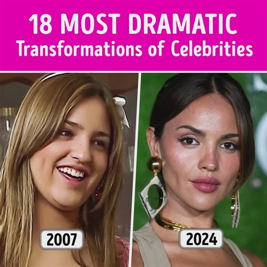 18 Celebrities Who Underwent the Most Dramatic Transformations | Celestoria