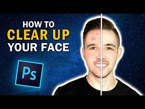 How To CLEAR UP your FACE in Photoshop | Easiest Method in 2024
