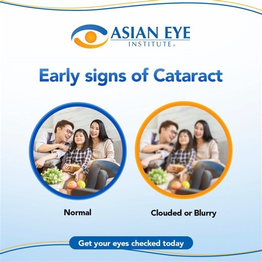 Are you experiencing symptoms such as blurry vision or seeing halos around lights? You might have cataract! This Cataract Awareness Month, it's important to prioritize the health of your eyes. Get your eyes checked at Asian Eye today and ensure that you receive the best possible care for your eyes. #AsianEye2024 #CataractAwarenessMonth | Asian Eye Institute