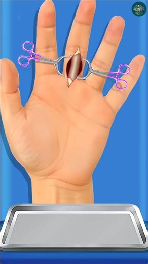 ASMR Hand Finger Surgery Treatment 🖐️ | Deep Cleaning & Healing Care #asmr #shorts #oddlysatisfying