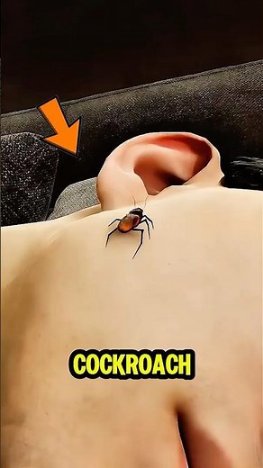 How to Get a Bug Out of Your Ear Safely 🪳 #medical #tips #hacks