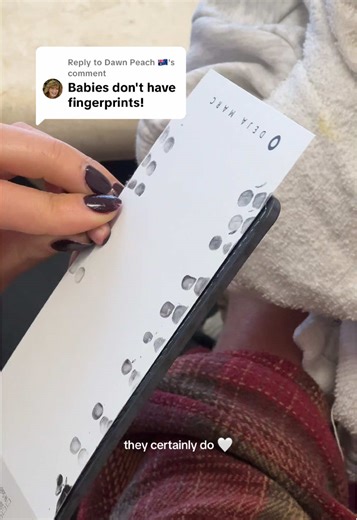 Understanding Fingerprint Development in Babies